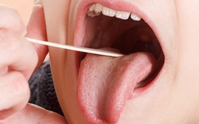 همه چیز درباره جراحی لوزه