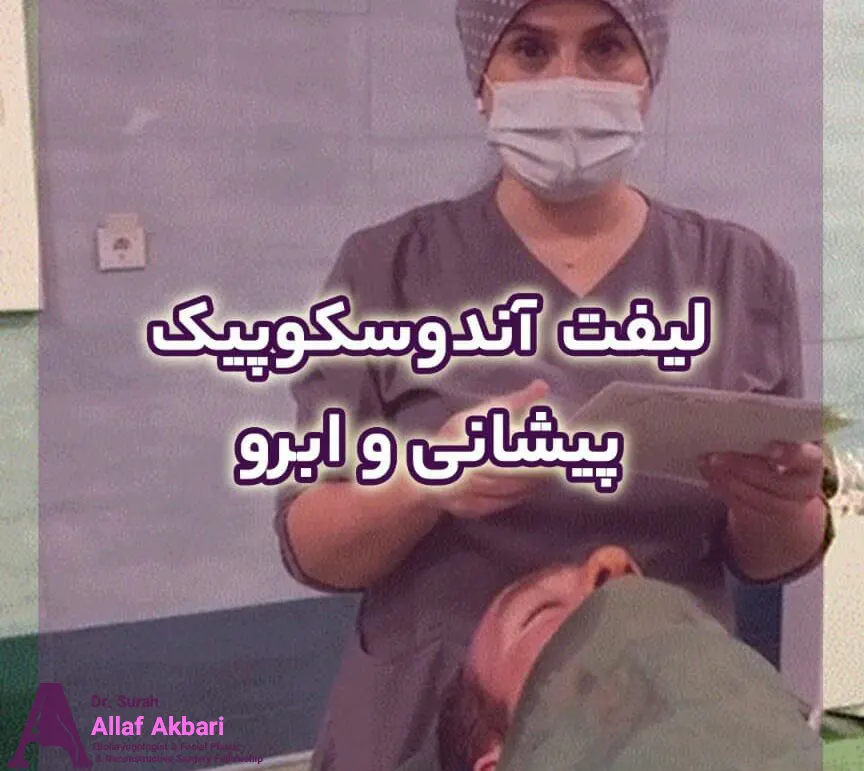 بهترین دکتر لیفت آندوسکوپیک پیشانی و ابرو