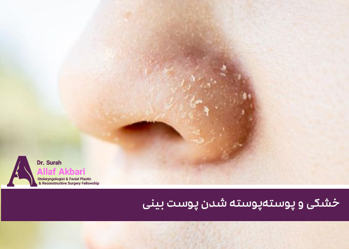 خشکی و پوسته‌پوسته شدن پوست بینی
