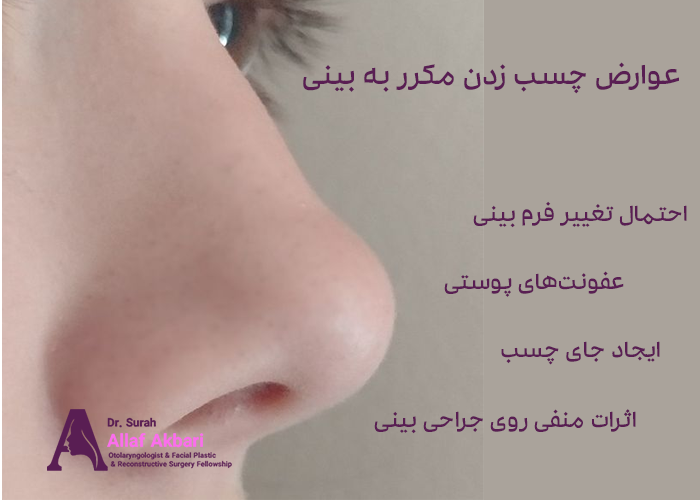 عوارض احتمالی چسب زدن مکرر به بینی