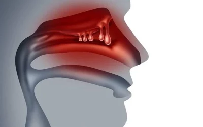 آیا پولیپ بینی خطرناک است؟